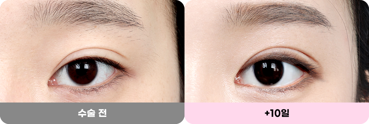 디에이 화려한 세미아웃