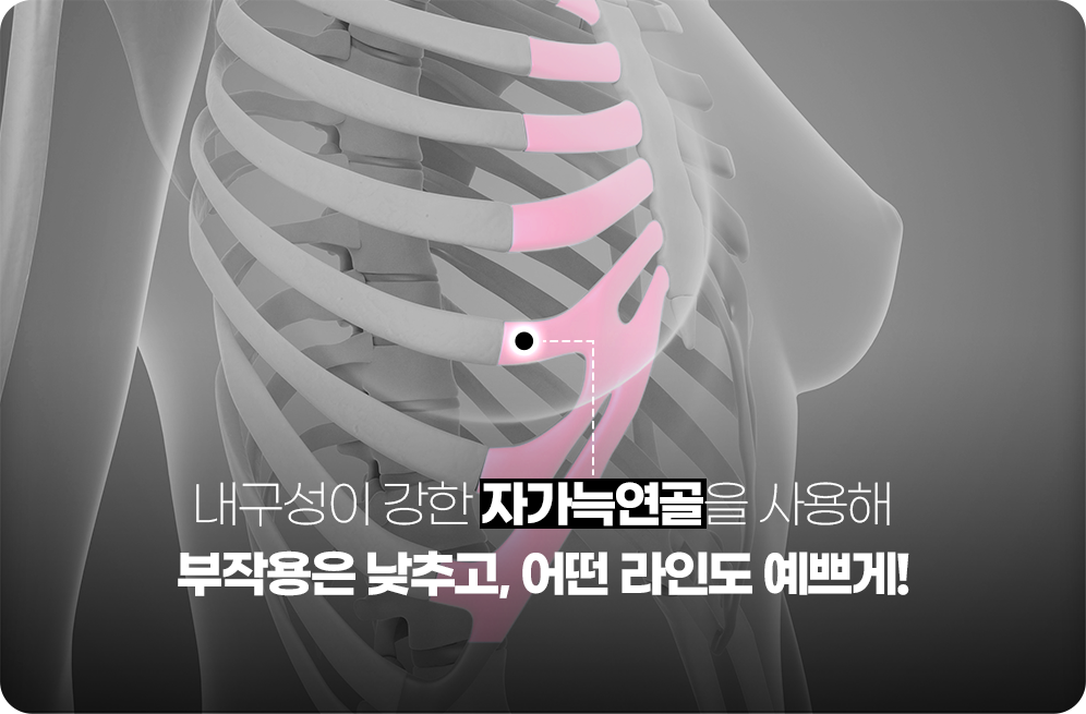 디에이 자가늑 코성형