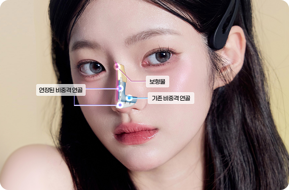 디에이 각도 코성형