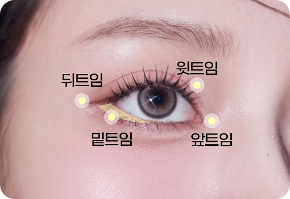 디에이 눈매확장트임