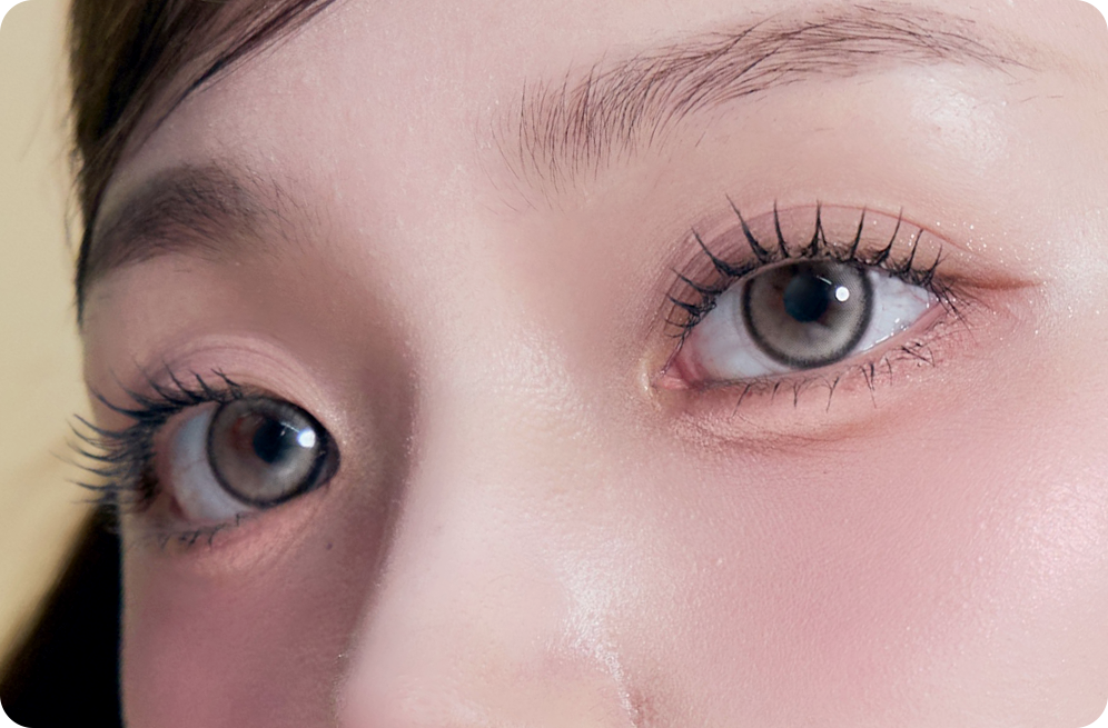 디에이 눈매확장트임