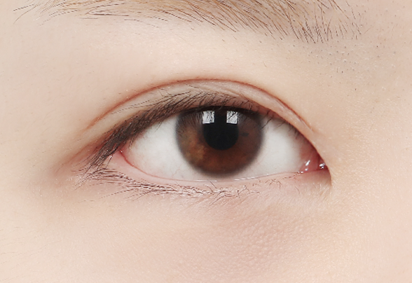 디에이 몽고트임