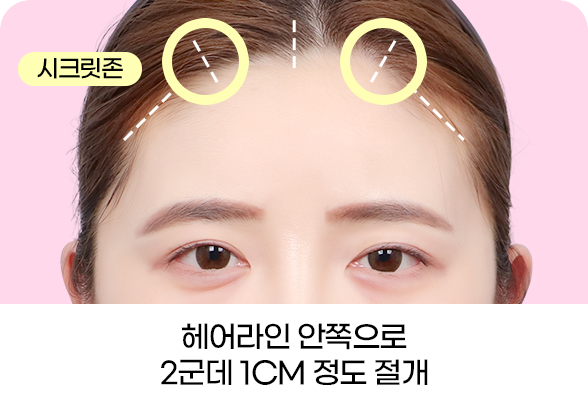 디에이 브로우업