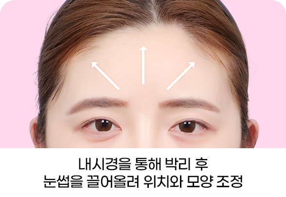 디에이 브로우업