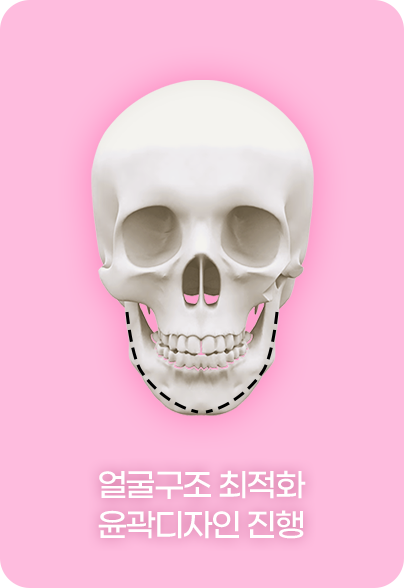 디에이 노핀윤곽