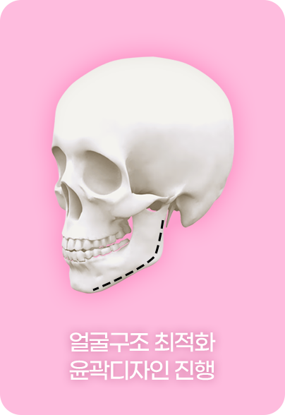 디에이 노핀윤곽