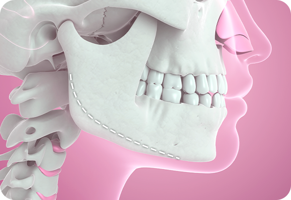 디에이 노핀윤곽