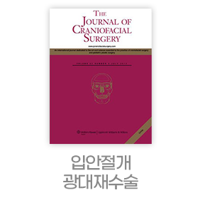 디에이 노핀윤곽