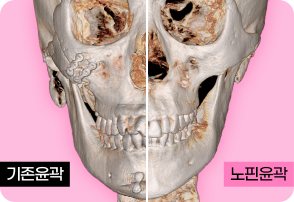 디에이 노핀윤곽