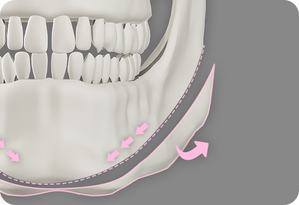 디에이 노핀윤곽