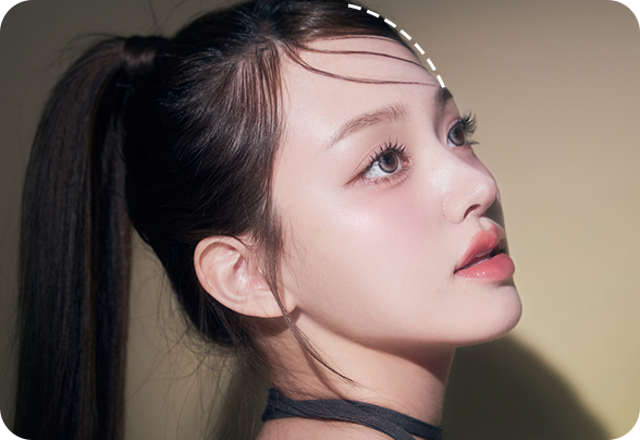 디에이 보형물윤곽