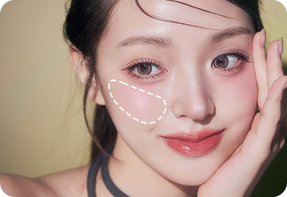 디에이 보형물윤곽