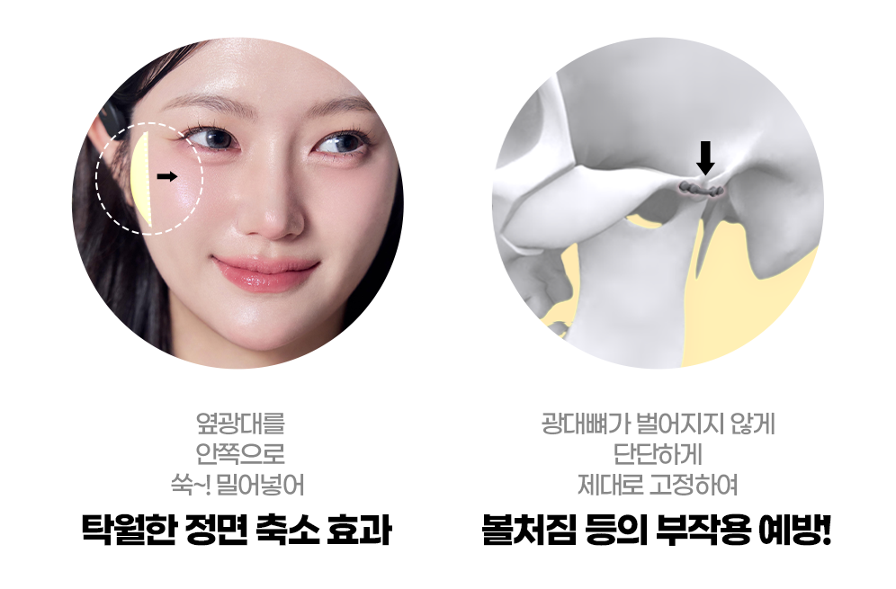 디에이 윤곽2종