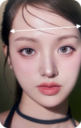 안면윤곽 재건 세밀진단 케이스