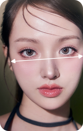 안면 비대칭 케이스 윤곽 재수술