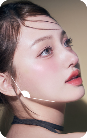 광대 거리 비대칭 안면윤곽 재수술