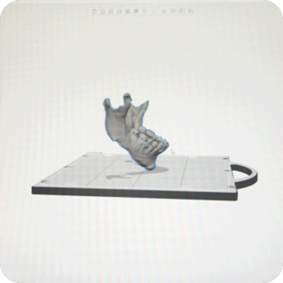 3D CT 기반 모델링