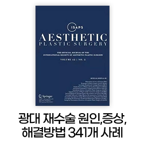 광대 재수술 원인,증상,해결방법 341개 사례