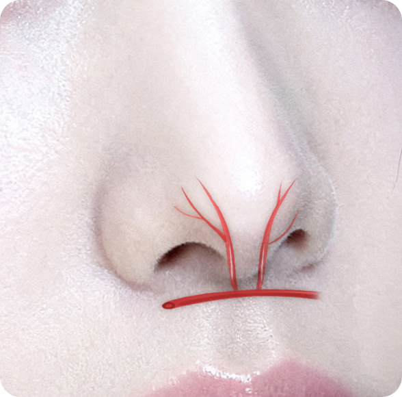 비주동맥 보존이미지