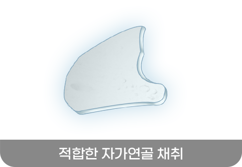 적합한 자가연골 채취