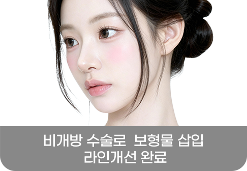 비절개 수술로 보형물 삽입 라인개선 완료