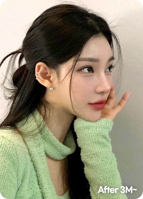 디에이 올아이 리프팅