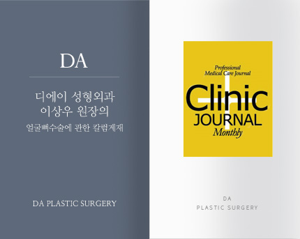 [칼럼게재] <2013 7월호 Clinic Journal> 얼굴뼈 수술에 관한 칼럼게재