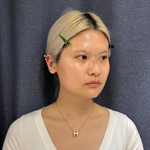 수술 전 (1)_500.jpg