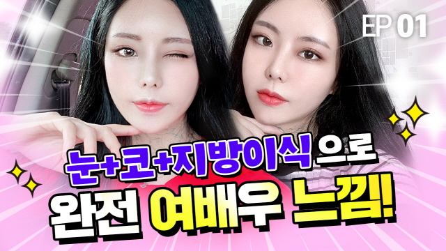 절개눈매(재)+뒤밑트임+코성형+지방이식